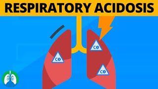 Respiratory Acidosis amp Alkalosis  AcidBase Imbalance [upl. by Utham]