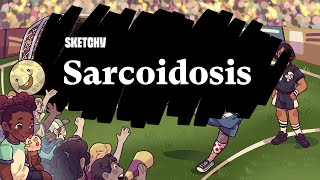 Understanding Sarcoidosis Causes Symptoms amp Treatment Part 1  Sketchy Medical  USMLE Step 2 CK [upl. by Ttenna]