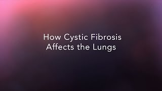 Idiopathic Pulmonary Fibrosis The Simple Facts [upl. by Sorgalim]