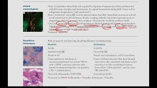 Listeria Monocytogenes Nocardia vs Actinomyces  Microbiology  13  First Aid USMLE in UrduHindi [upl. by Rabbi]