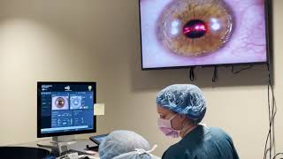 Live PRK Procedure at Commonwealth Eye Surgery [upl. by Llert514]