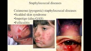 BIO2020 Episode 028 the staphylococci [upl. by Nuyh]