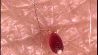 60 seconds of a bed bug nymph feeding  Rentokil [upl. by Robins]