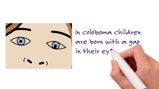 Microphthalmia Anophthalmia and Coloboma [upl. by Ayota]