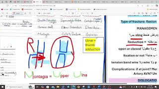 UPPER LIMB FRACTURES  ORTHOPEDICS  5TH YEAR [upl. by Hahsia]