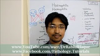 Haemophilia  Definition Types Pathogenesis Clinical Features Diagnosis Treatment  HD [upl. by Tuneberg650]