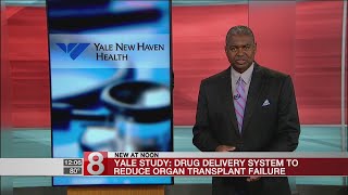 Yale develops drug delivery system to reduce organ transplant complications [upl. by Edaj517]