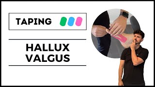 TAPING pour un HALLUX VALGUS [upl. by Adrial]