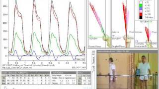 Loads Acting in the Hip Joint During Walking [upl. by Pepi]