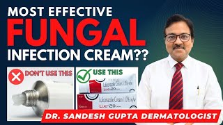 Never Use Steroid Creams In Fungal Infection  Fungal infection treatment by Dr Sandesh Gupta [upl. by Ailegra]