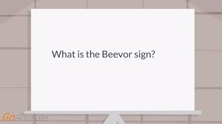 What is the Beevor sign [upl. by Margarete]