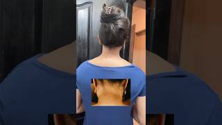 😳This is how i removed my Neck Suntan Dark Neck Remedysuntanremoval youtubeshorts [upl. by Sandie973]