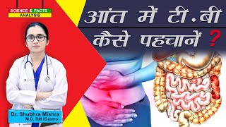 आंत की टी बी कैसे पहचानें   Abdominal Tuberculosis [upl. by Norraa771]