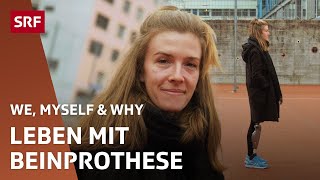 Frau mit Beinprothese – Neue Challenges und Umgang mit Behinderung  We Myself amp Why  SRF [upl. by Weeks]