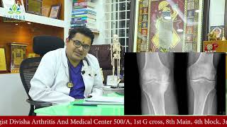 Dr Vijay KR Rao Rheumatologist Bangalore Karnataka India [upl. by Nerrual998]