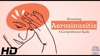 Aerosinusitis Sinus Pain in the Skies [upl. by Hennebery987]