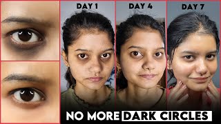 Get Rid of DARK CIRCLES Naturally in 7 Days  Permanent Solution of Dark Circle  Remove Dark Circle [upl. by Quinlan]