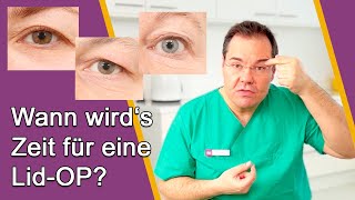 AugenlidOP – Ab wann ist OP sinnvoll Gibt es Alternativen ohne OP Dr Günther Düsseldorf [upl. by Baily]