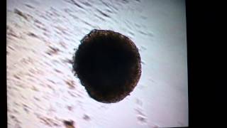 Beating 10 day old embryoid body from mES cells [upl. by Ynnek]