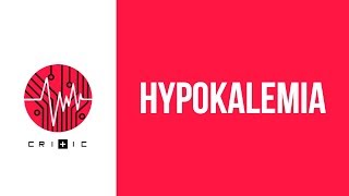 Hypokalemia  an easy workup [upl. by Ahsenra]