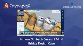 AMANN GIRRBACH CERAMILL MIND BRIDGE CASE DESIGN [upl. by Biddie]