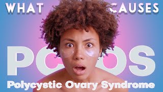 Why PCOS is More Than Just Ovaries [upl. by Atiniv943]