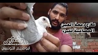 اقوي علاج لدمعة العين المصاحبة للبرد في الحمام من ابو مريم التونسي [upl. by Osnola]