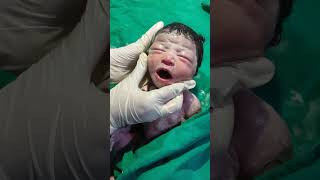 Essential care of new born baby viralvideo love littleprince littleprince godblessyou [upl. by Sira]