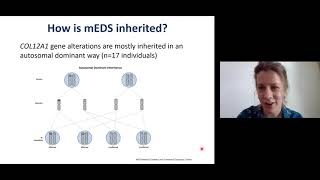 Myopathic EDS mEDS  Dr Fleur Van Dijk  English EN [upl. by Tjader]