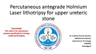 Percutaneous antegrade PCNL Holmium Laser lithotripsy of upper ureteric stone [upl. by Prestige]