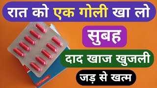 बस 1 गोली से दाद खाज खुजली को जड़ से खत्म करे  Best Red Capsule For Dad Khaj Khujali Problem  Dinai [upl. by Anairb]