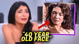 Kylie Jenner BREAKSDOWN After Her Botched Frozen Face Surgery [upl. by Danielle]