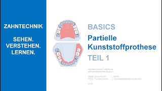 Partielle Kunststoffprothese  Teil 1 [upl. by Lucienne]