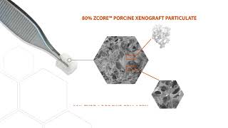 Zcore™ Form Moldable CollagenEnriched Porcine Xenograft [upl. by Poppas]