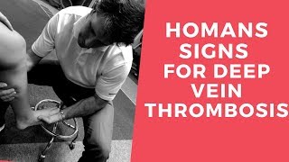 Homans Sign for Deep Vein Thrombosis [upl. by Brigit]