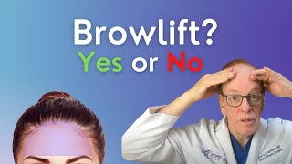 Benefits of Brow Lift Surgery  Plastic Surgeon Explains EyeBrow Lifts [upl. by Stefanac716]