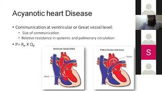 Acyanotic Heart Disease  Peads  Paediatrics Lecture  MBBS  Ample Medical Lectures [upl. by Kciredec]