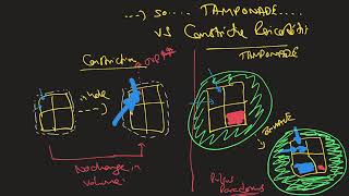 Understanding Kussmauls Sign [upl. by Berthold]