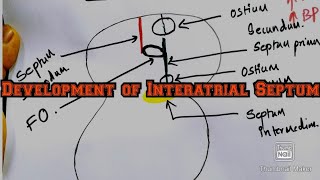 Development of Interatrial SeptumEmbryologyMBBS [upl. by Melba]