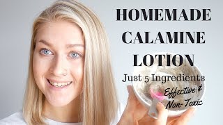 5 Ingredient DIY Calamine Lotion amp Powder  Homemade Calamine Lotion [upl. by Mariam663]