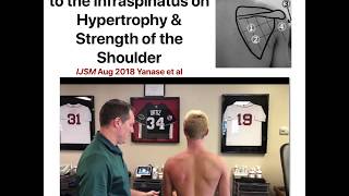 Electrical stimulation to the rotator cuff [upl. by Nisior588]