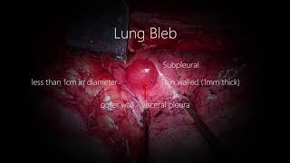 Lung Blebs Bullae [upl. by Ivel]