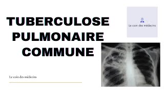 TUBERCULOSE PULMONAIRE COMMUNE [upl. by Harwell]