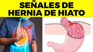 ASI EMPIEZA la HERNIA DE HIATO y nadie te lo dice signos y síntomas de hernia hiatal [upl. by Verne]