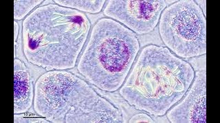 Difference between Monocot Root and Dicot Root  Botany Tamil [upl. by Remliw692]