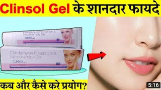 Clinsol gel review in hindi एक्ने पिम्पल ऑयली स्किन के लिए असरदार दवा Clinsol gel uses [upl. by Claudio]