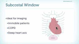 Introduction to the Subcostal View [upl. by Eiffub]