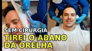 TIREI O ABANO DA ORELHA SEM CIRURGIA  OTOMODELAGEM  OTOMODELAÇÃO  COMO FAZER OTOPLASTIA FECHADA [upl. by Joacima]