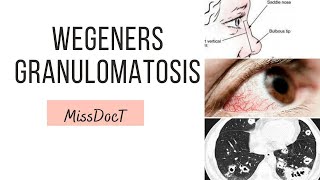 GRANULOMATOSIS WITH POLYANGITIS Wegeners Granulomatosis [upl. by Connell]