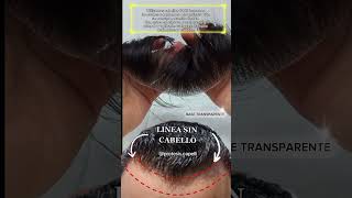 Prótesis Capilar frontal para Hombre  Cabello humano protesiscapilares [upl. by Dnomyaw]